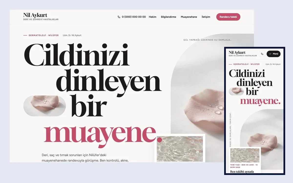 Ten teması: masaüstü ve telefon görünümü